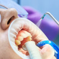 Safety Measures for Air Abrasion in Dental Clinics