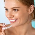 Protecting Your Smile: The Significance Of Dental Safety In Spark Aligners Treatment For London Patients