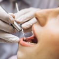 Safeguarding Smiles: The Crucial Role Of Dental Safety In Vancouver