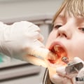 Keeping Your Child's Smile Safe: Pediatric Dental Emergencies In Gainesville, VA