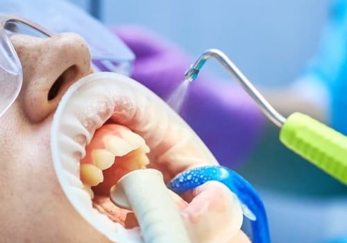 Safety Measures for Air Abrasion in Dental Clinics
