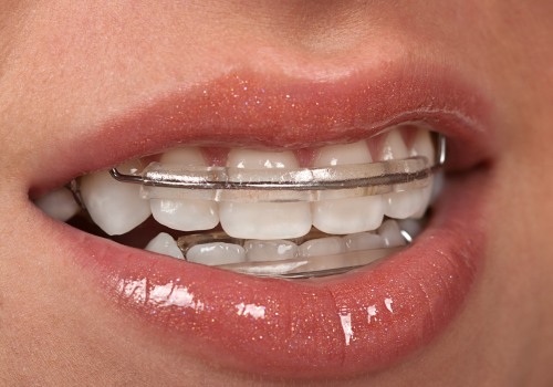 Why Dental Safety Matters: Choosing A Trustworthy Cosmetic Dentist In Bexley